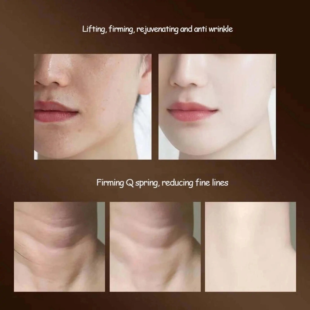 EternalLift™ | 3-in-1 Beauty Sculptor – Antirughe & Lifting EMS™