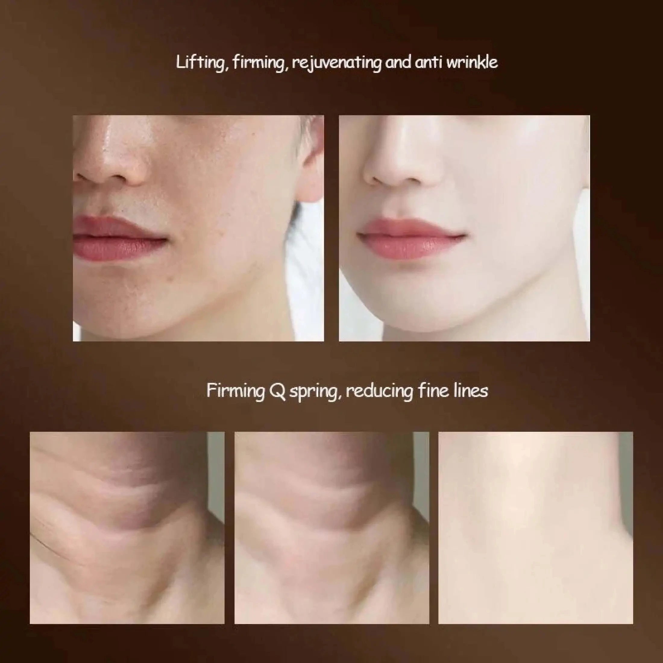 EternalLift™ | 3-in-1 Beauty Sculptor – Antirughe & Lifting EMS™