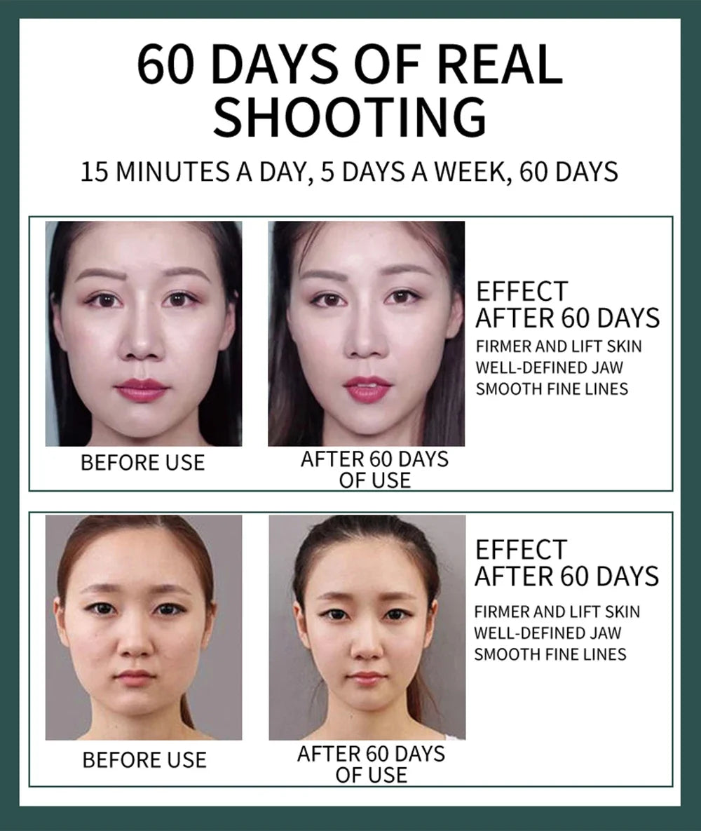 V-Lift Pro™ - Massaggiatore Facciale Fototerapia & Lifting EMS | Qualità Premium | Modellatore Corpo 2-in-1