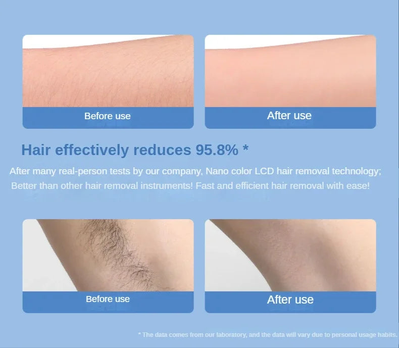 SilkSkin™ – Epilatore in Nano-Cristalli Indolore | Esfoliante & Anti-Irritazione | Donna & Uomo